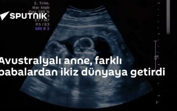 gebelik ikizleri