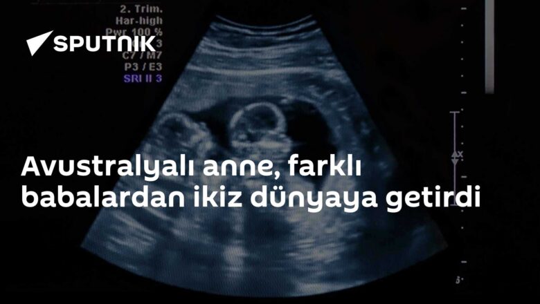 gebelik ikizleri